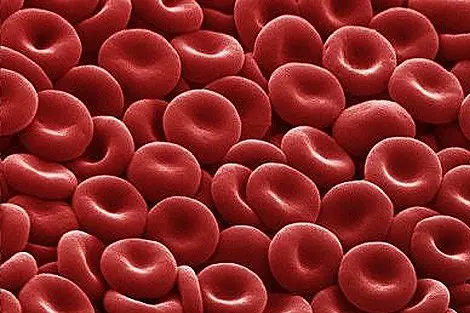 Pierdere scăzută a vederii hemoglobinei - Hemoglobina vederii