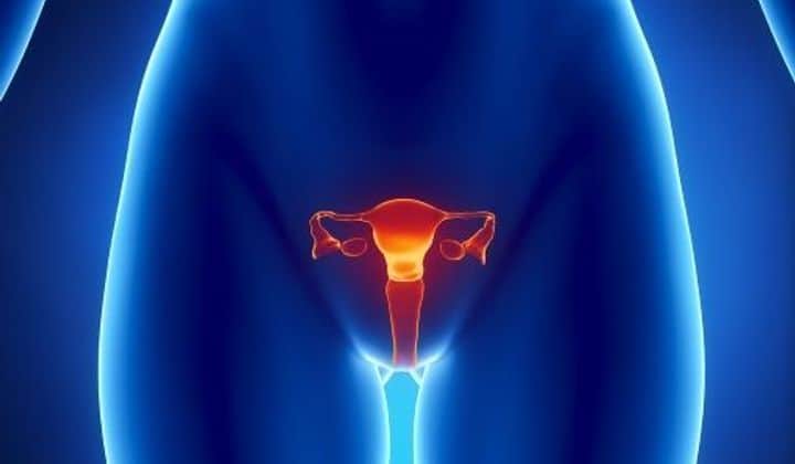 Cancer de col uterin - Complicatii